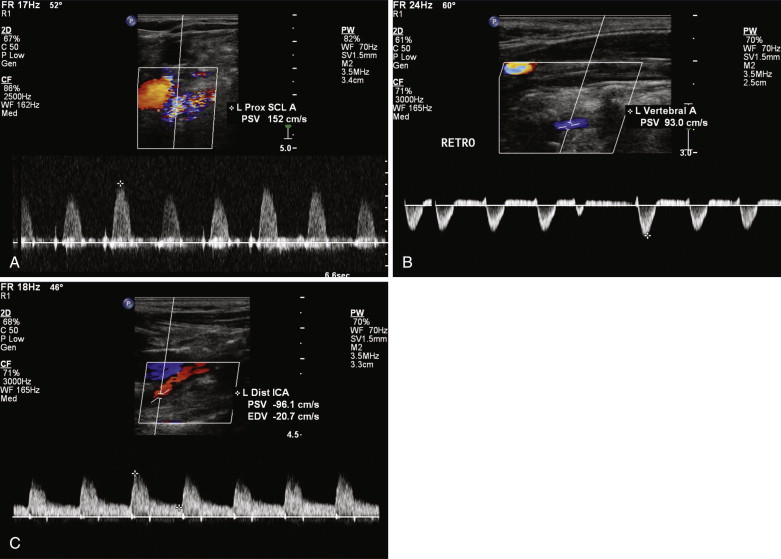 Vascular Ultrasound Radiology Key