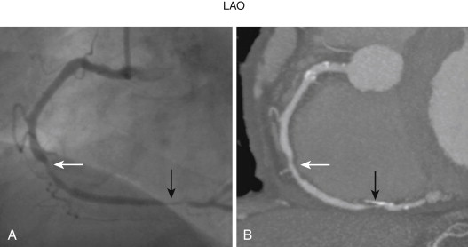 Comparative Anatomy | Radiology Key