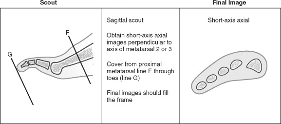 Foot And Ankle Radiology Key 8408