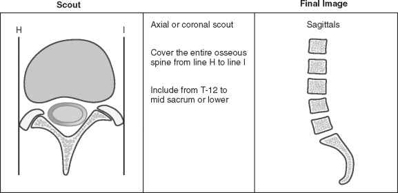 Spine | Radiology Key