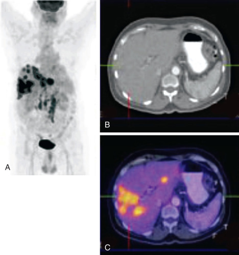 Introduction | Radiology Key