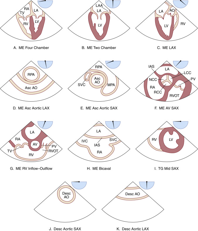 Transesophageal Echocardiogram 4 Chamber