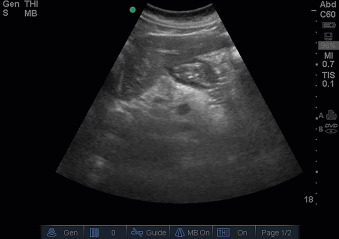Abdominal Ultrasound   F21-04-9780323596428