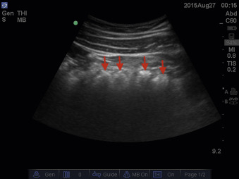 Abdominal Ultrasound   F21-06-9780323596428