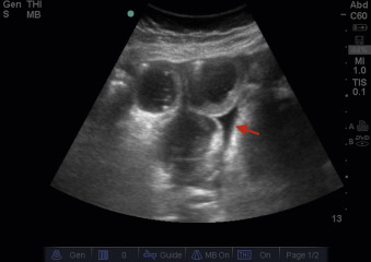 Abdominal Ultrasound   F21-09-9780323596428