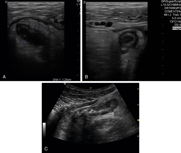Abdominal Ultrasound   F21-14-9780323596428
