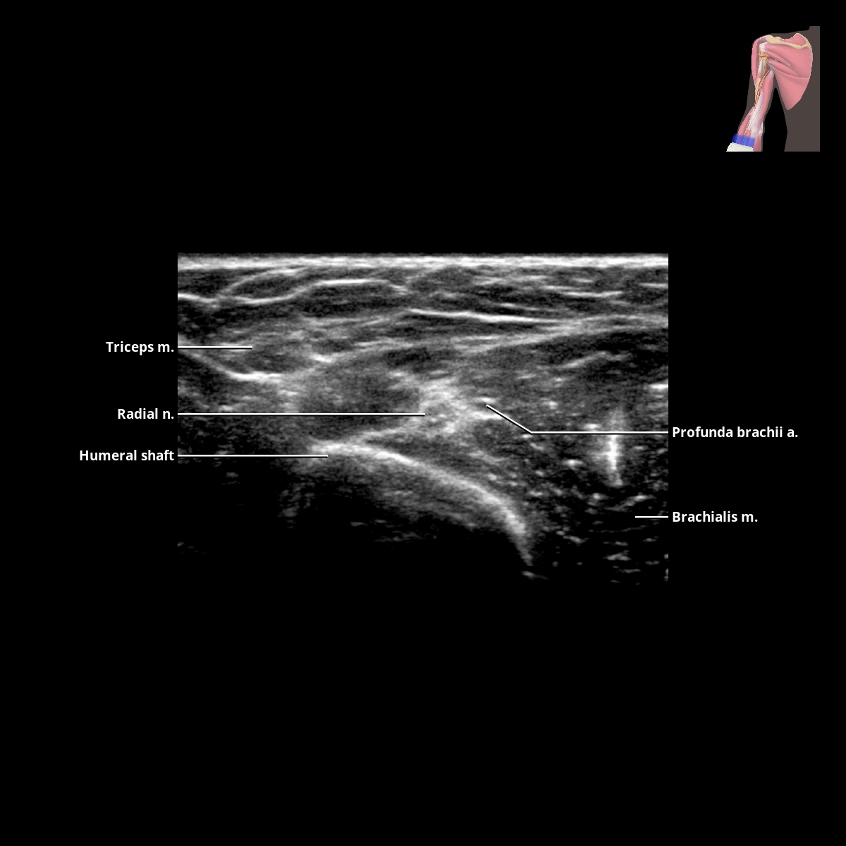 Arm | Radiology Key