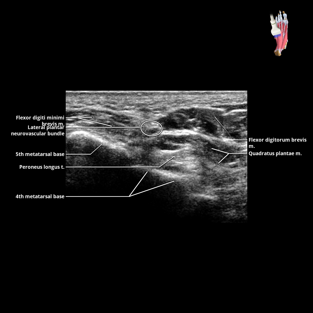 Tarsus | Radiology Key