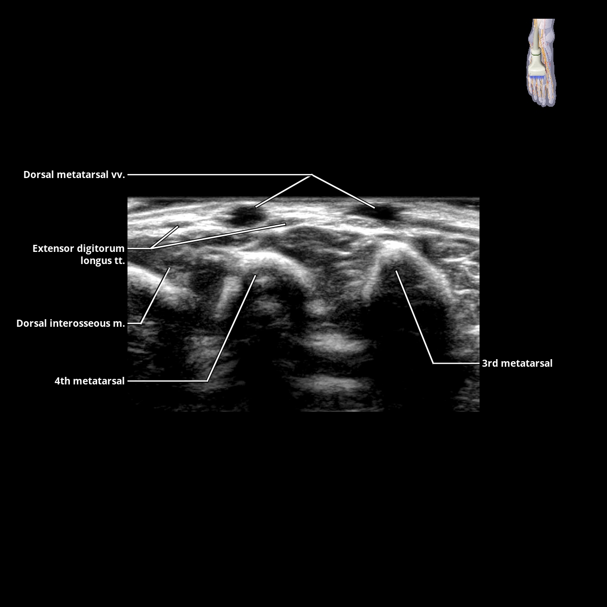 Foot Vessels | Radiology Key