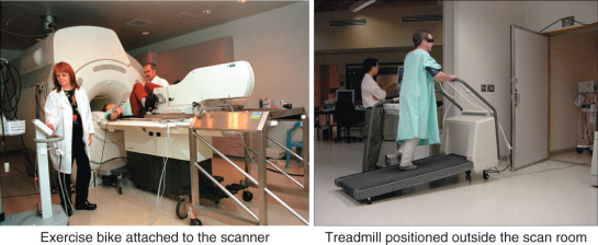 Motion Radiography Stress Cardiovascular Magnetic Resonance: Wall Motion | Radiology Key