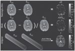 Flow-Compensated IVIM in the Ballistic Regime: Data Acquisition, Modeling, and Brain Applications