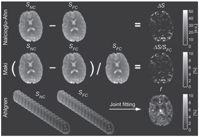 Flow-Compensated IVIM in the Ballistic Regime: Data Acquisition ...