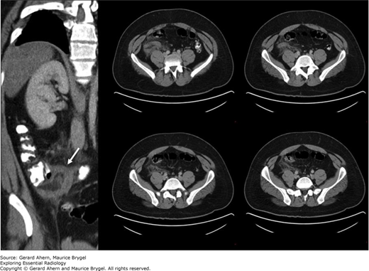 Abdomen | Radiology Key