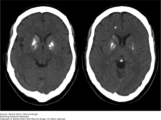 Head | Radiology Key