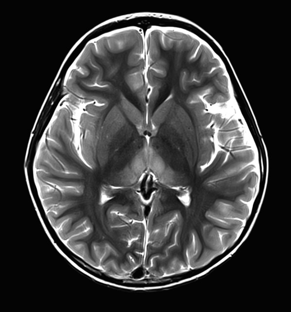 14 Metabolic Disorders | Radiology Key