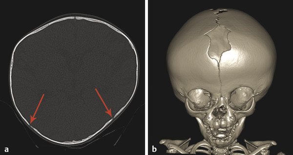 18 Craniofacial | Radiology Key