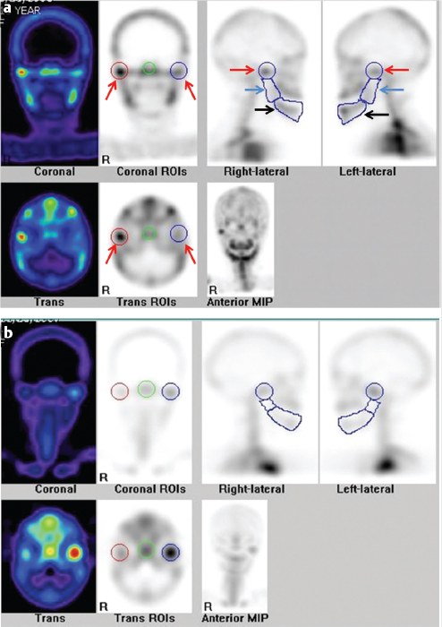 8 SPECT and SPECT/CT for the Skeletal System | Radiology Key