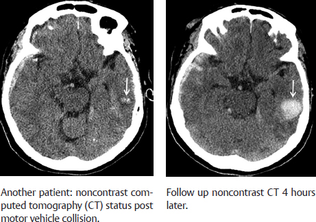 SECTION III DIAGNOSTIC RADIOLOGY IMAGING | Radiology Key