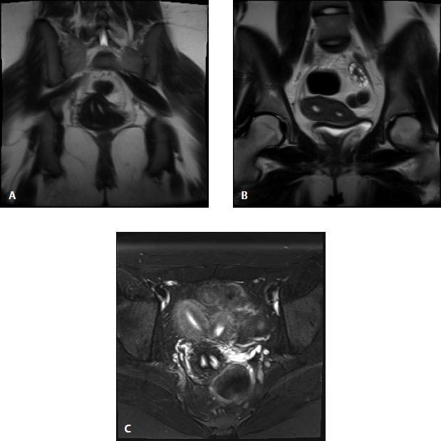 Section V Genitourinary Imaging Radiology Key 