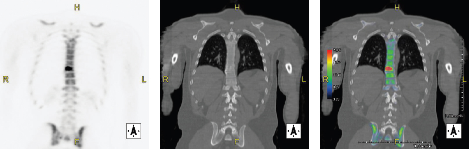 SECTION IX NUCLEAR MEDICINE IMAGING | Radiology Key