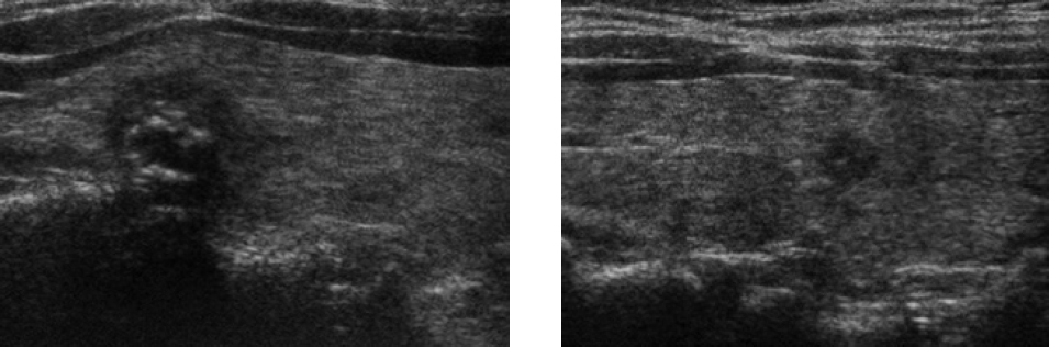 SECTION XII US/REPRODUCTIVE/ENDOCRINOLOGY IMAGING | Radiology Key