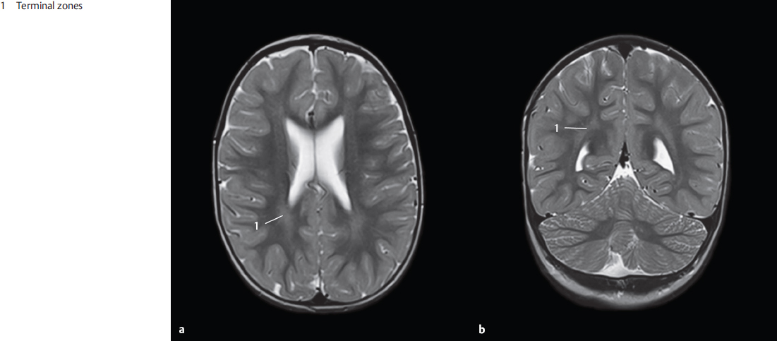 Part III Topography Of The Head And Neck | Radiology Key