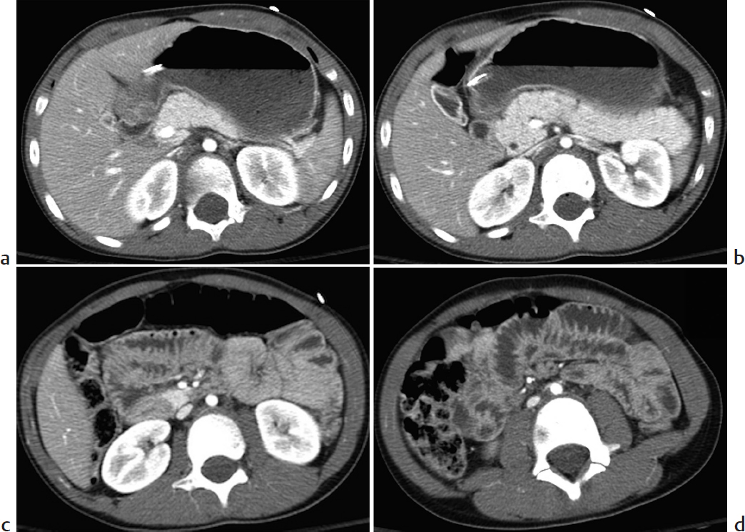 Part 2 Gastrointestinal Imaging | Radiology Key