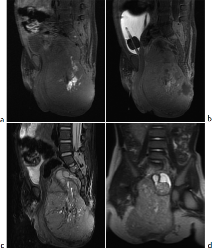 Part 3 Genitourinary Imaging Radiology Key