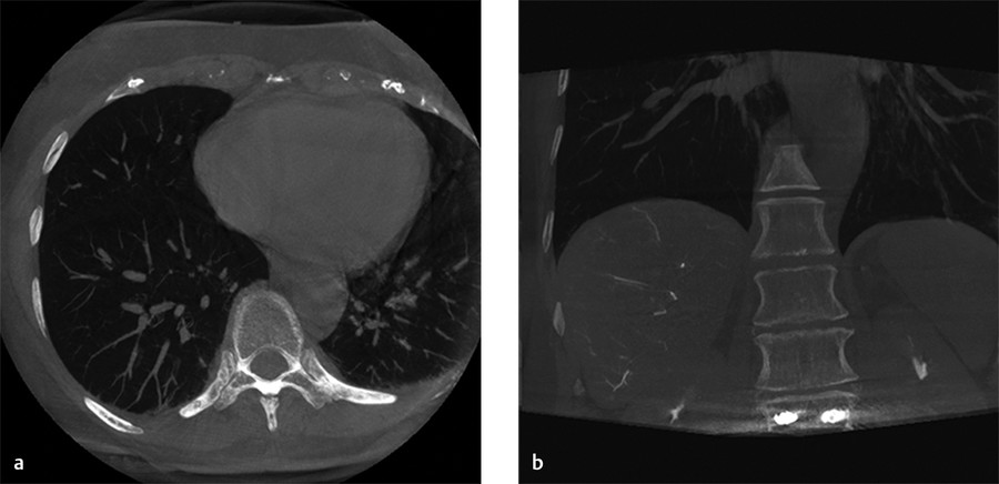 1-fluoroscopy-radiology-key