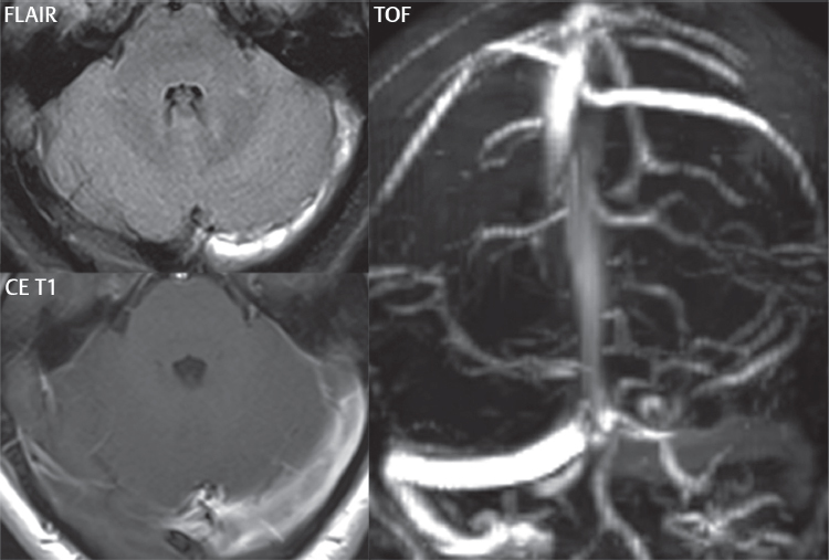 Vascular Lesions | Radiology Key