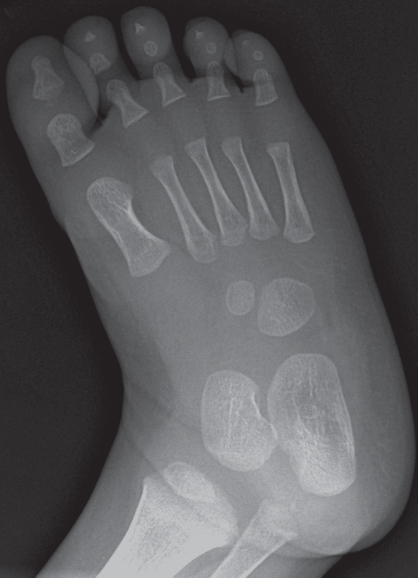 Male Foot | Radiology Key