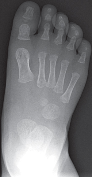 Male Foot | Radiology Key