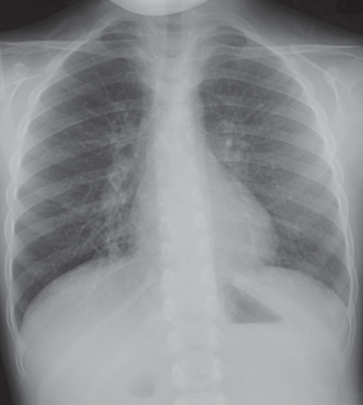 Female Chest | Radiology Key