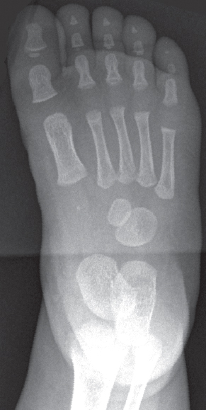 Female Foot | Radiology Key