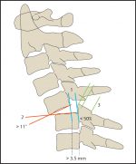 Craniocervical Junction and Cervical Spine