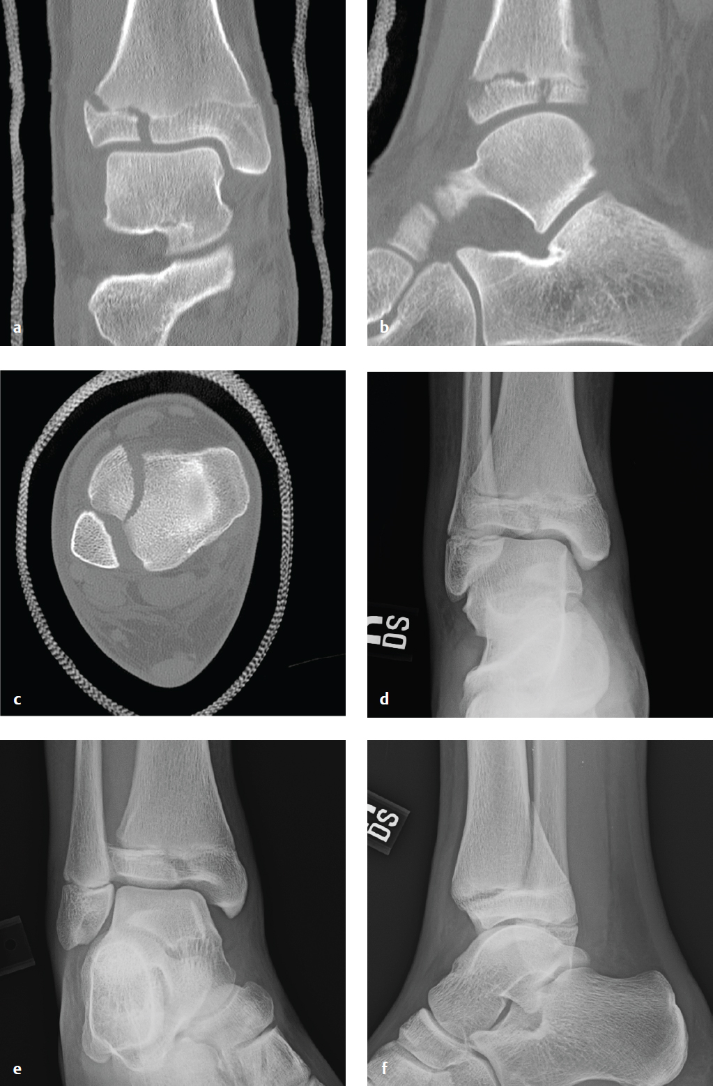 pediatric radiology pictorial essay