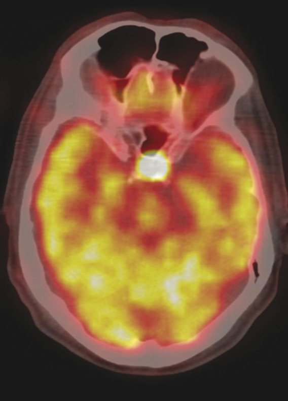 12 Molecular Imaging: PET And SPECT | Radiology Key