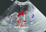 3 Neonatal Cranial Ultrasonography