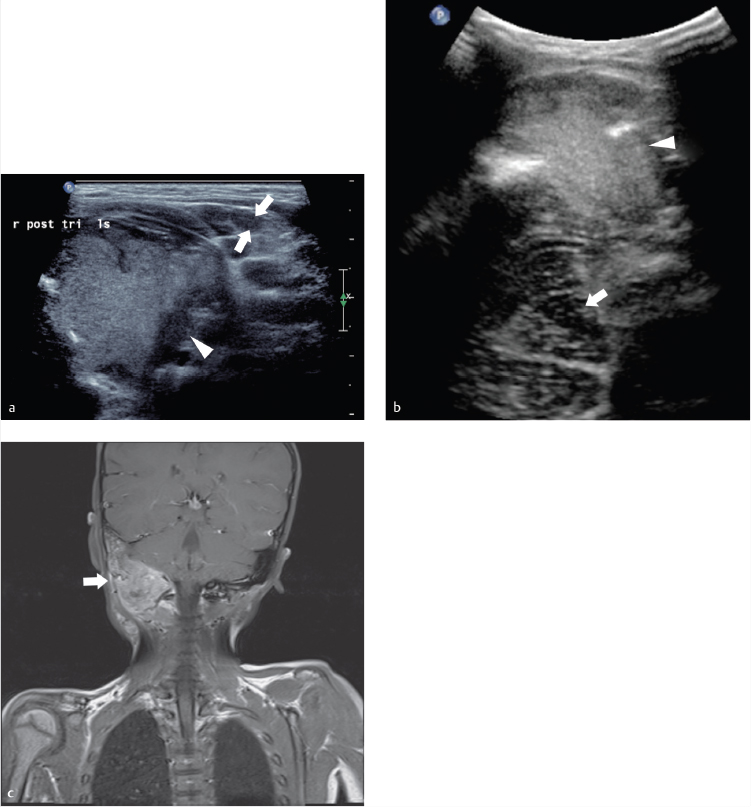 17 Musculoskeletal Ultrasound | Radiology Key