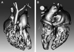 Advances in MR Imaging Assessment of Adults with Congenital Heart Disease
