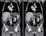 Volumetric X-ray Imaging
