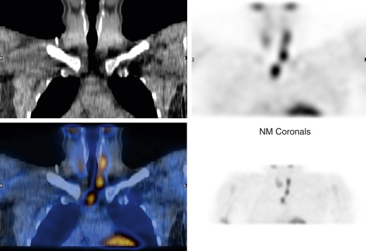 Endocrine System | Radiology Key