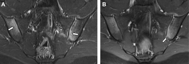 Beyond Crohn Disease | Radiology Key