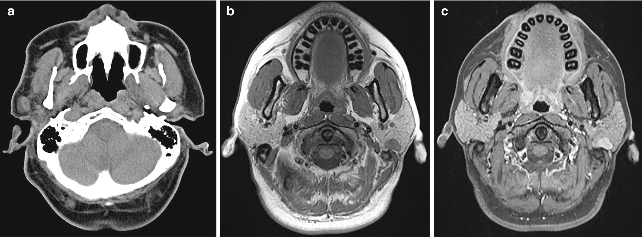 Glands | Radiology Key