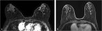 5 Diagnostic MRI: Imaging Protocols and Technical Considerations