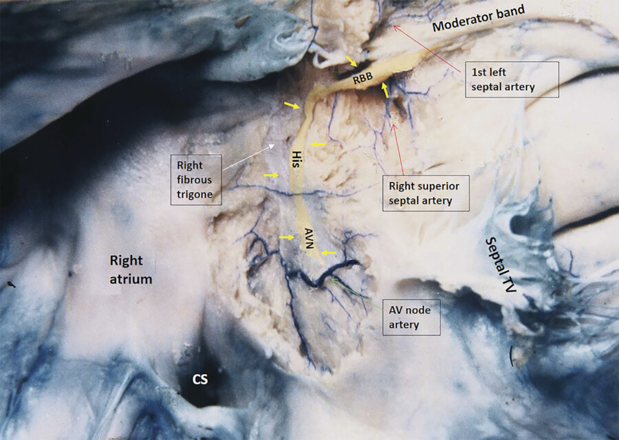 12 General Anatomy of the Heart | Radiology Key