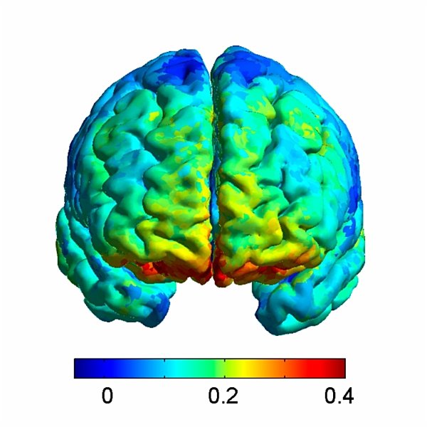 Orbitofrontal Cortex (Area 11) | Radiology Key