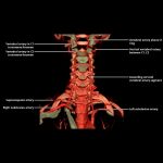 Aortic Arch and Great Vessels