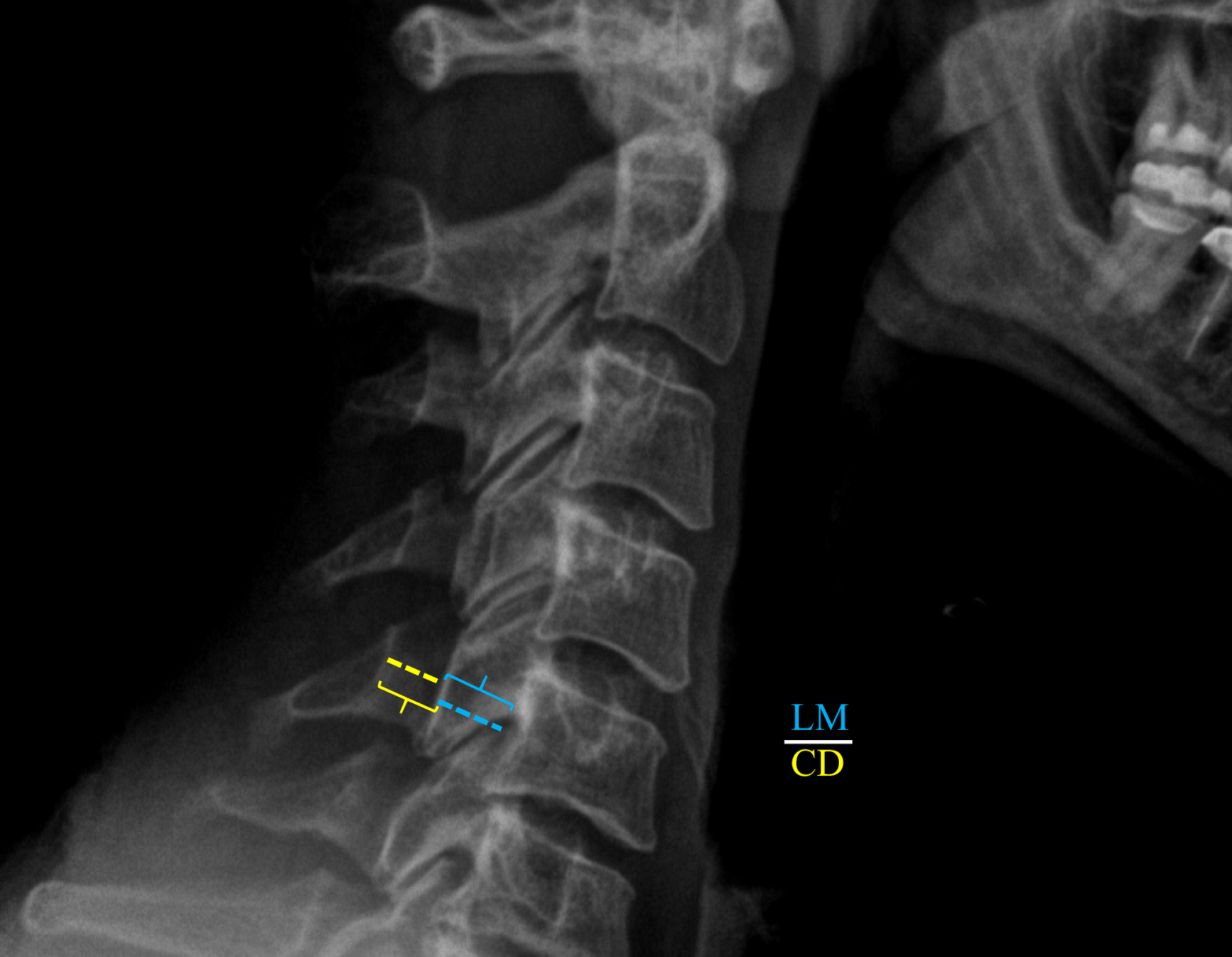 Clinical Correlations to Specific Phenotypes and Measurements With ...