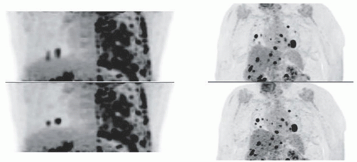 Nuclear Tomographic Imaging—Single Photon and Positron Emission ...
